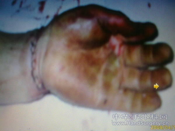 201103201337.jpg