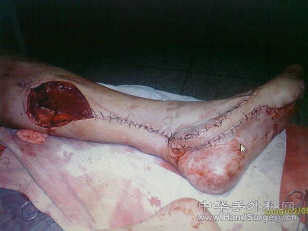 201103201335.jpg