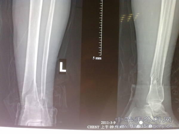 201103201328.jpg
