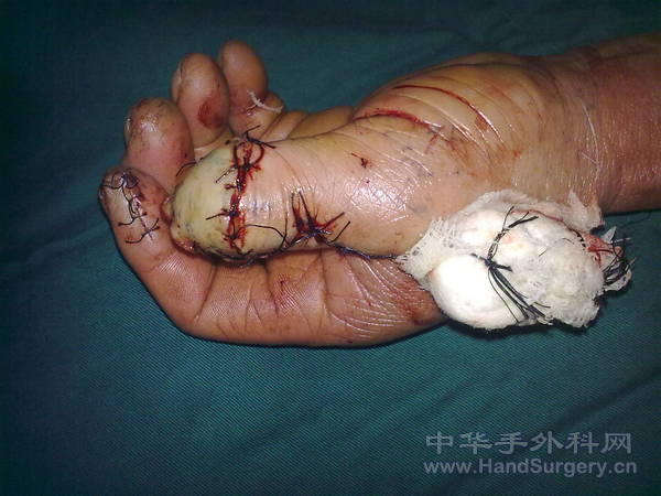 201103131304.jpg