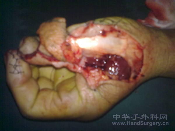 201103131303.jpg
