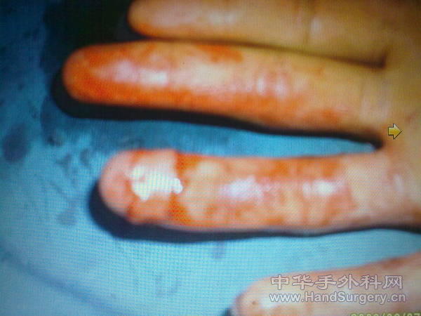 201103201358.jpg