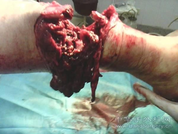 http_imgload[71].jpg