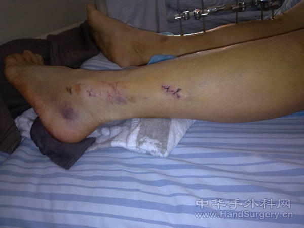 20110414451.jpg