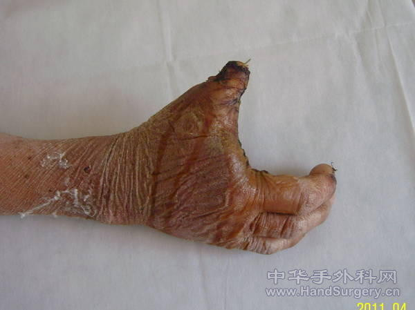 术后十八天复查2.jpg
