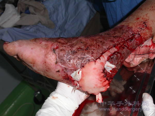 PICT0009.JPG