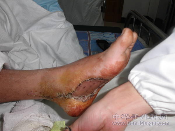 PICT0032.JPG