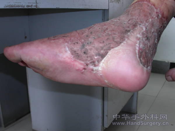 PICT0120.JPG