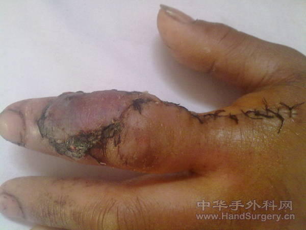 20110328909.jpg