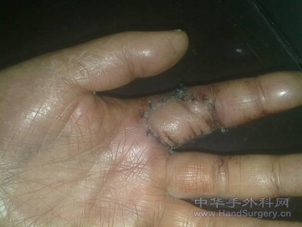20110312851.jpg