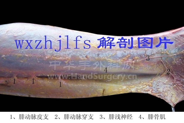 这张图片的腓动脉穿支清楚