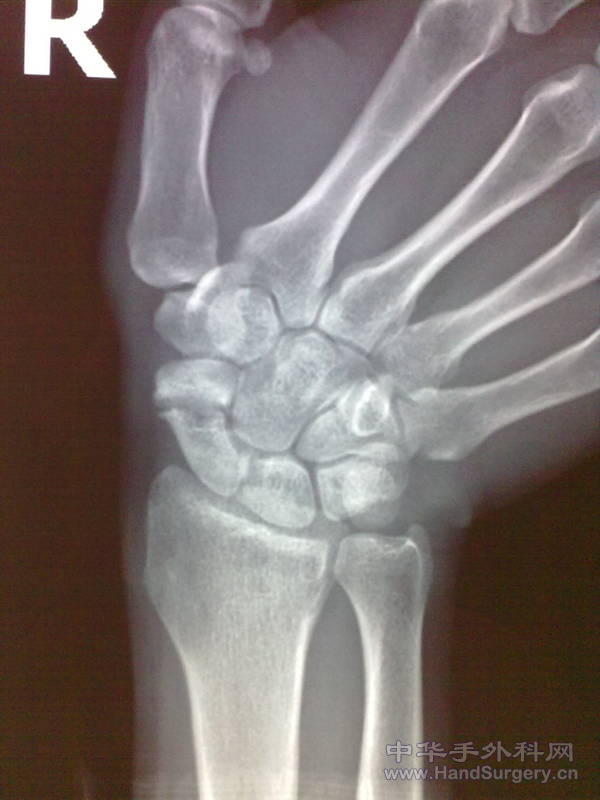 201104021436.jpg