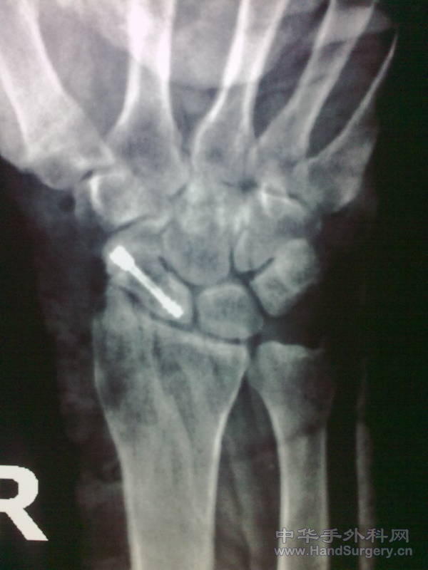 201104061468.jpg