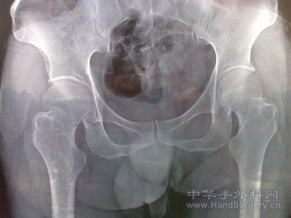 201103301417.jpg