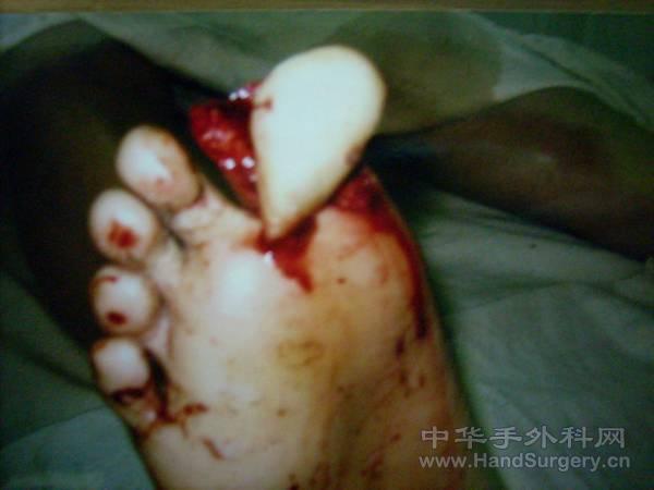 3.gif