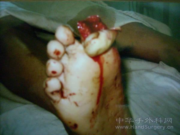 4.gif