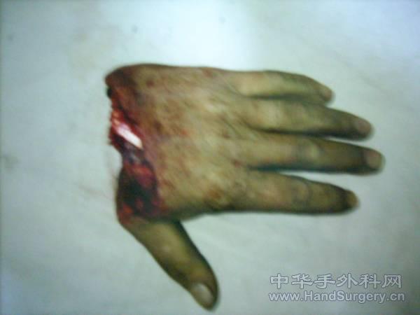 2.gif
