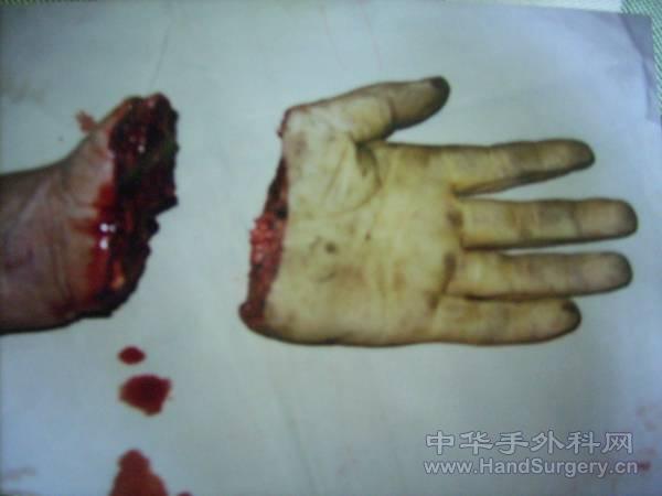 5.gif
