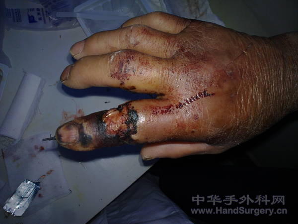 20101125345.jpg