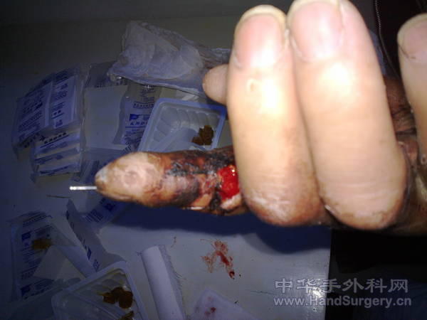 20101125347.jpg