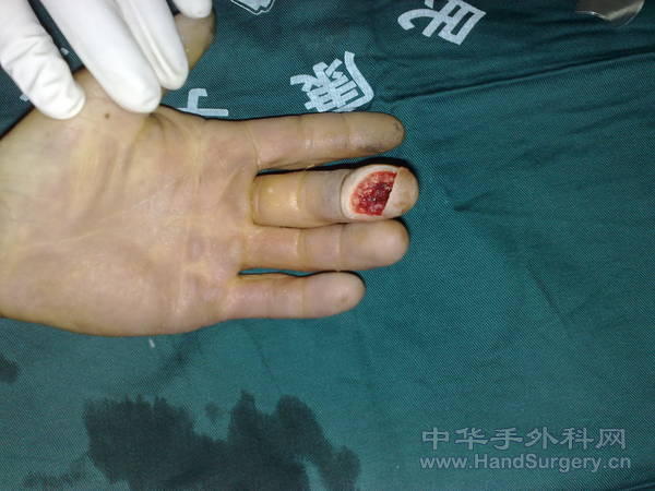20110408935.jpg