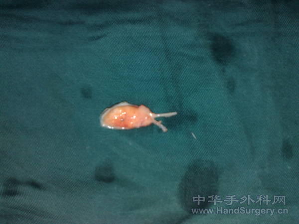 20110409945.jpg