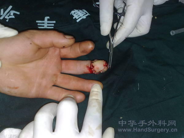 20110409951.jpg