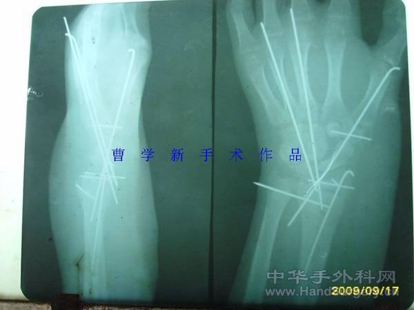 nEO_IMG_杨海兵35.jpg