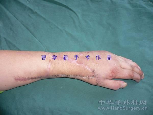 nEO_IMG_杨海兵36.jpg