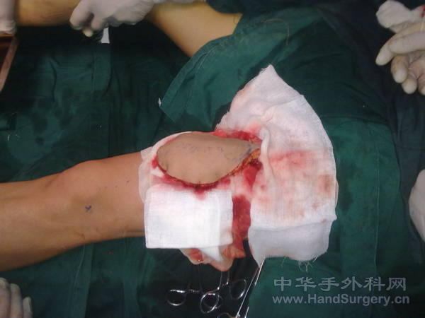 20110315104.jpg
