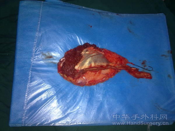20110315105.jpg