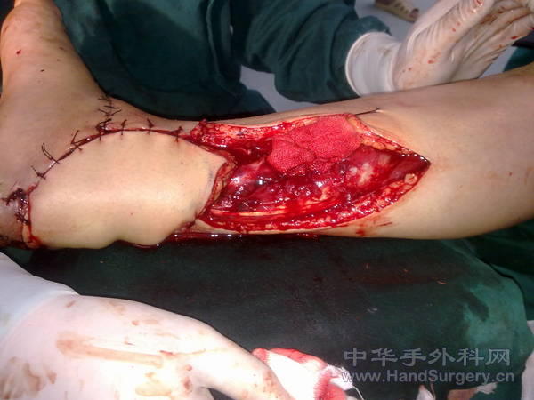 20110315107.jpg