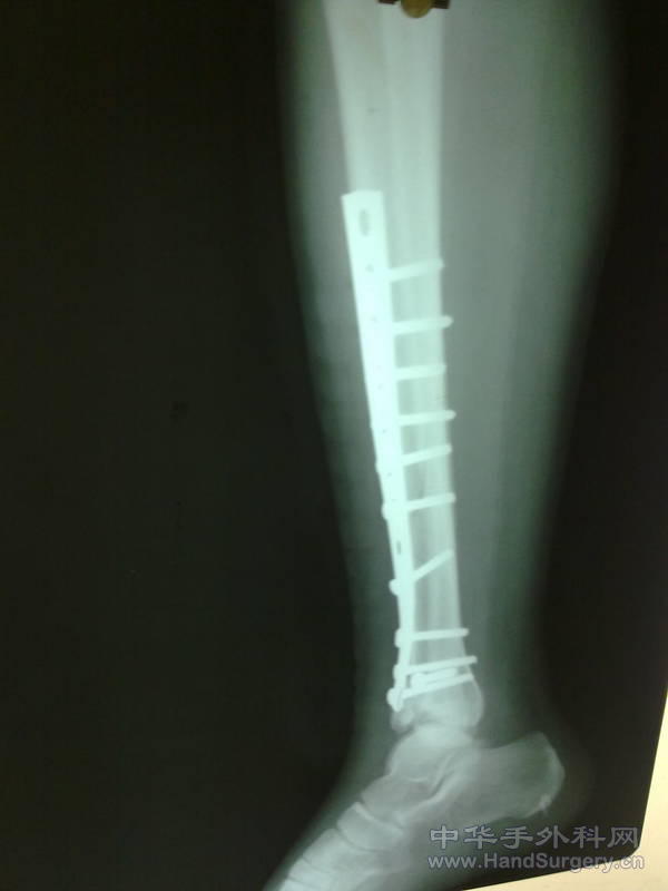 20110501222.jpg