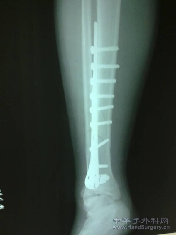 20110501223.jpg
