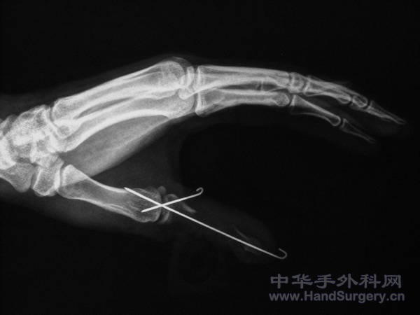 DSCN4352.JPG