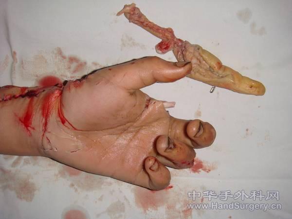 图片11.jpg