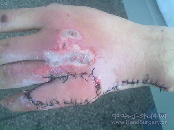 201105031087.jpg