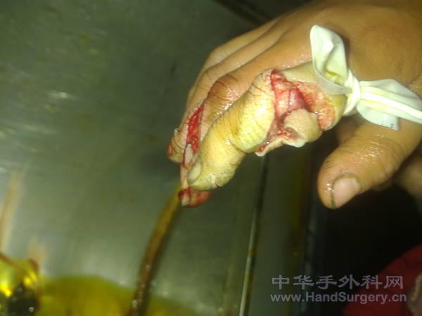 20110413186.jpg