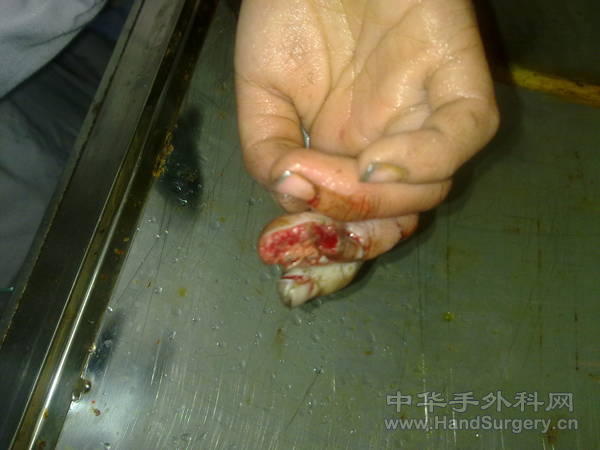 20110413188.jpg