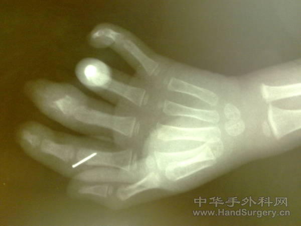 20110418201.jpg