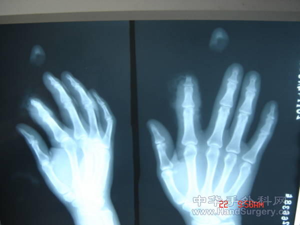照片 004.jpg