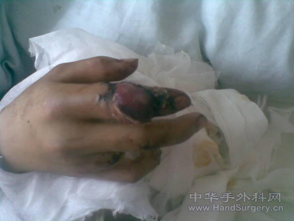 20101107.jpg