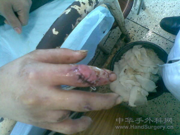 20101126.jpg