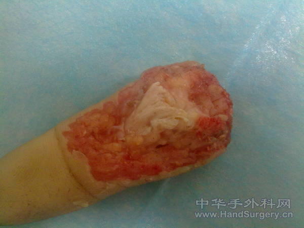 20110404918.jpg