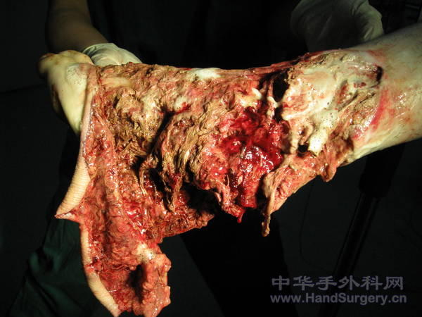 2受伤时情况.jpg