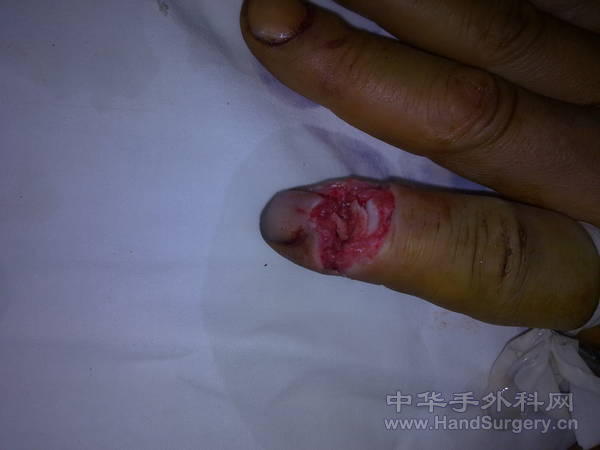 20110414452.jpg