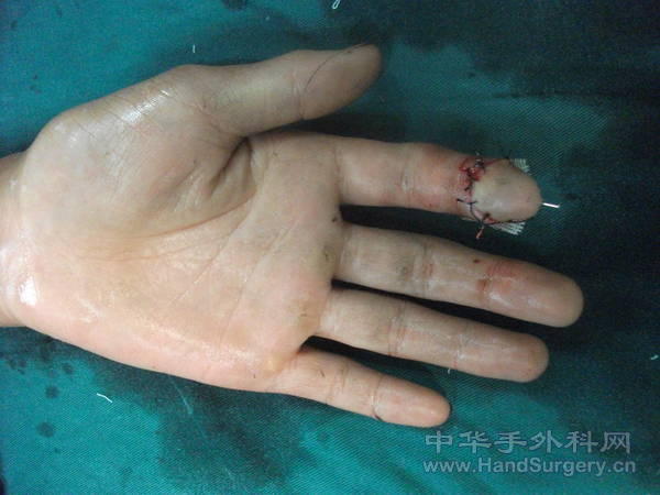 DSCF1850.jpg