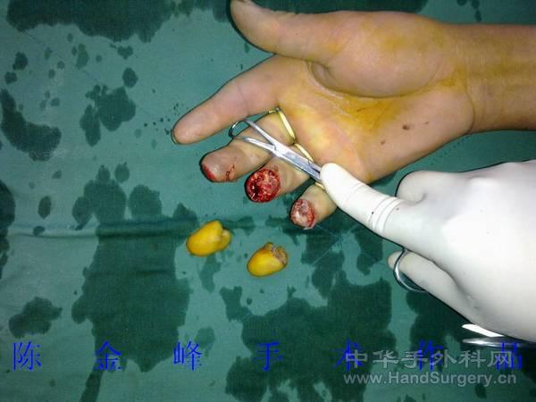nEO_IMG_20110501133.jpg