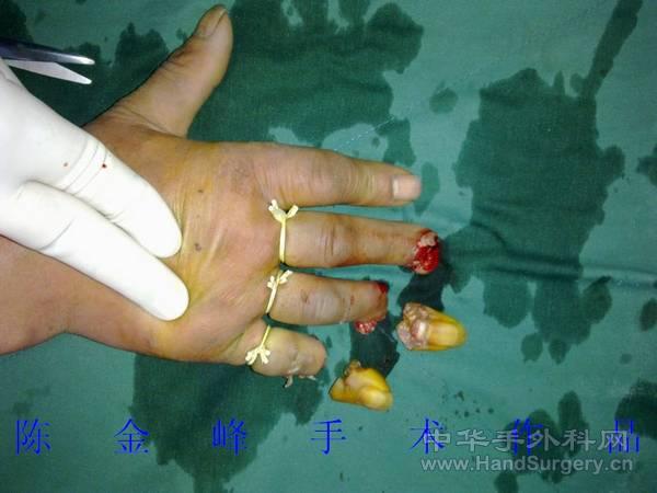 nEO_IMG_20110501138.jpg