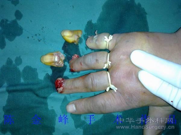 nEO_IMG_20110501139.jpg